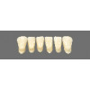 Široké zuby Klasické čelá 6 ks Super cenová akcia