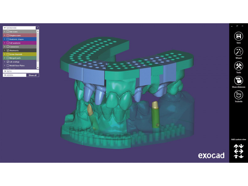 Exocad modul Model Creator (modely pre 3D tlač)