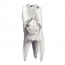Sadrové zuby Hinrichsova zbierka zubov '' Ecki ''