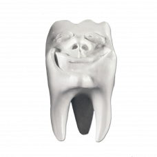 Sadrové zuby Hinrichsova zbierka zubov '' Backi ''