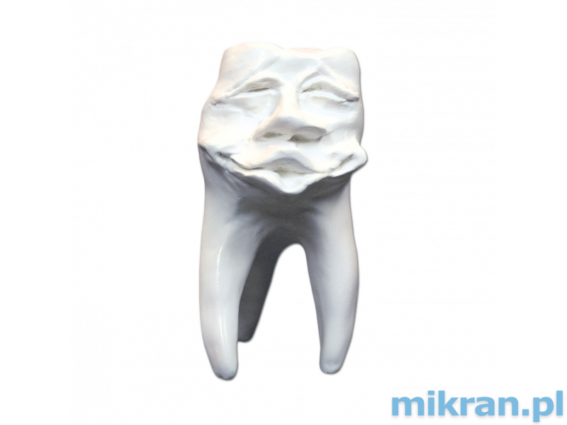 Hinrichova kolekcia zubov ''Mick'' sadrové zuby