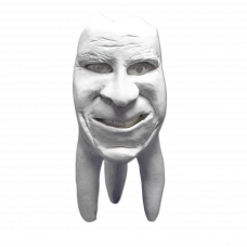 Sadrové zuby Hinrichsova zbierka zubov '' Joachim ''