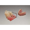 Formlabs živica Denture Base 1L - Živica na zubné protézy